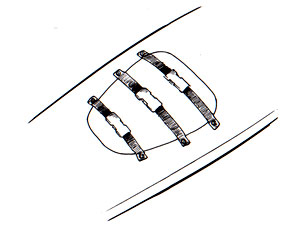 Flush Mounted Deck Hatches