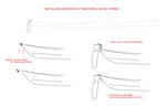 Smart Track Rudder System Thumbnail