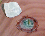 Footbrace Mounting Kit  (FMK) Thumbnail